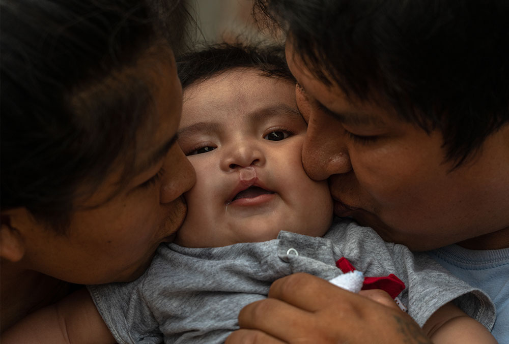 Zulema and Jose kiss Miguel just after his free Smile Train-sponsored cleft surgery