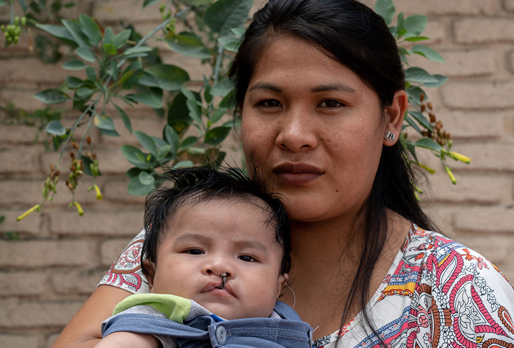 Zulema holds Miguel before his cleft surgery 