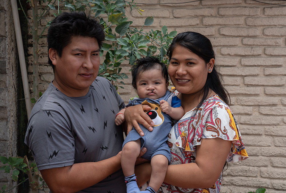 Miguel with his parents before cleft surgery
