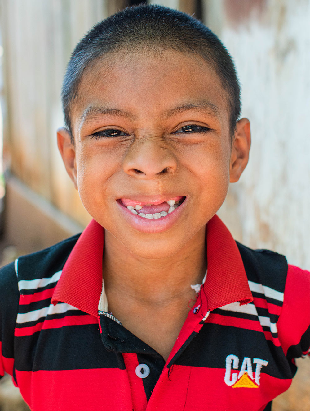 Auner flashes a toothless grin after free Smile Train cleft treatment in Guatemala