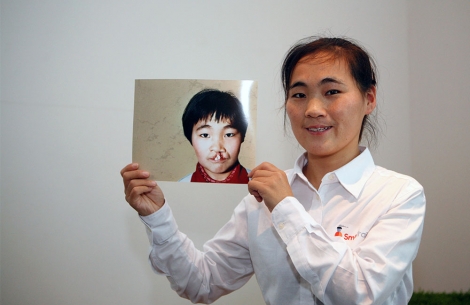 Wang Li, Smile Train's first patient, holds her before cleft surgery image
