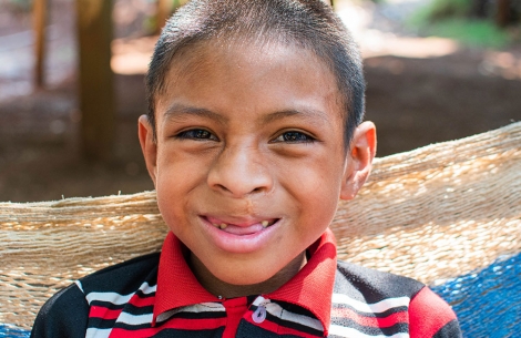 Auner smiling after free Smile Train cleft and lip surgery in Guatemala