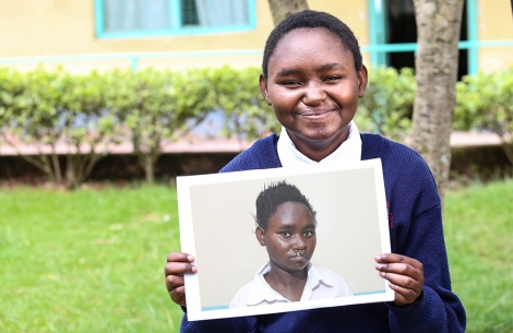 Smile Train patient Demaris from Kenya holds a picture of herself before her free cleft surgery