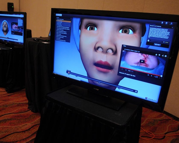Screen with images from virtual surgery simulator 