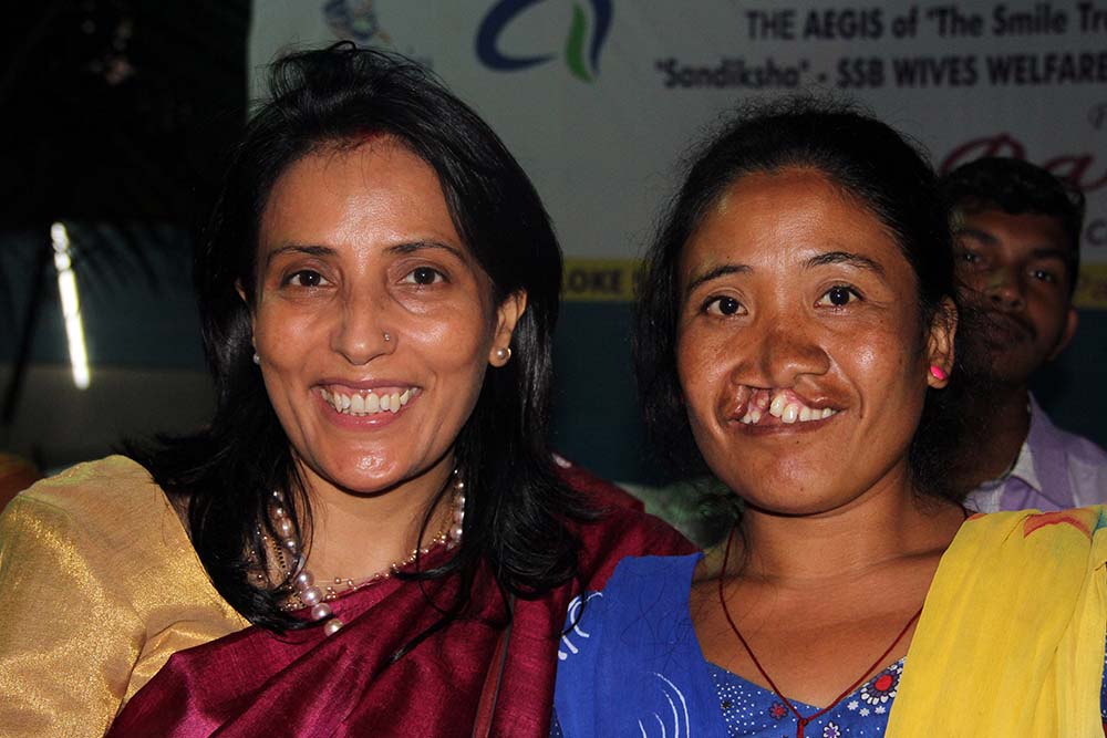 Mamta with a woman with untreated cleft lip