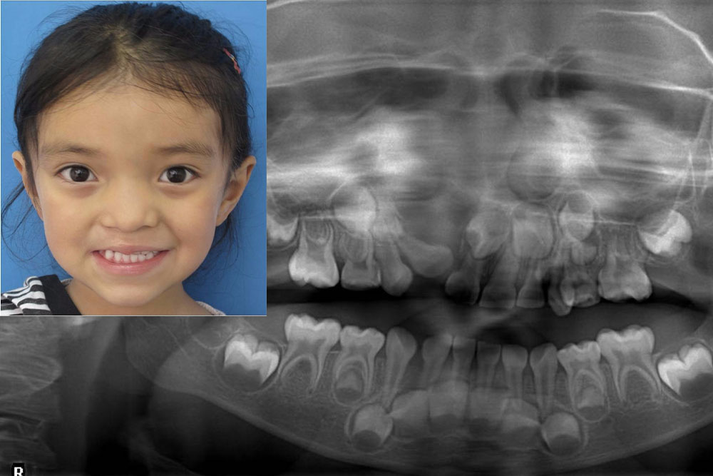 Maria next to her orthodontic xray image