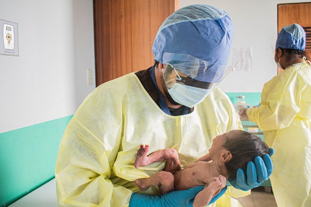 Mirian is near death due to cleft malnutrition