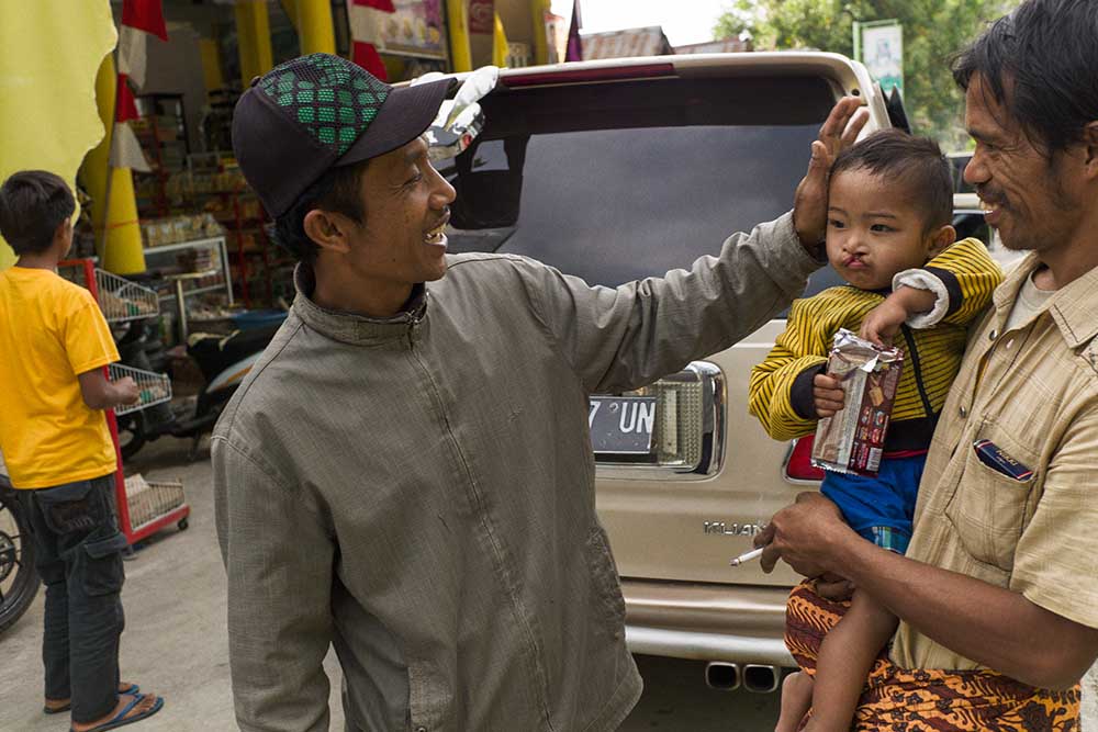 Natsir comforts a child with a cleft lip