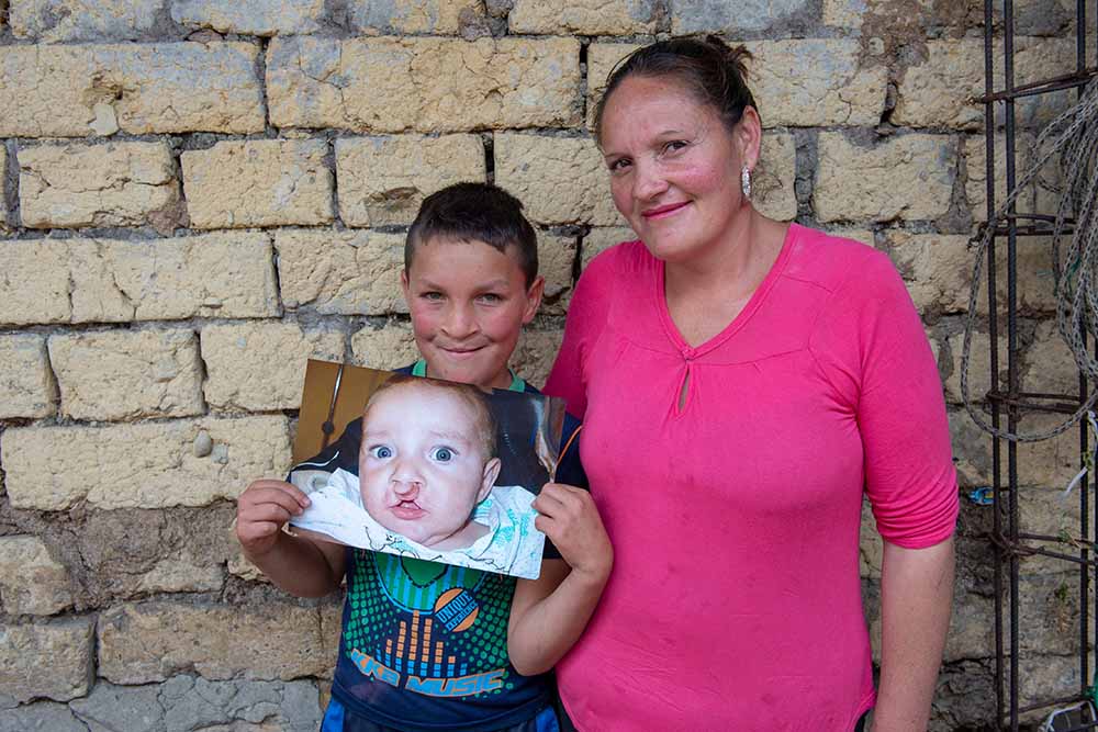 Neitan holding an image of himself before cleft lip surgery with his mom