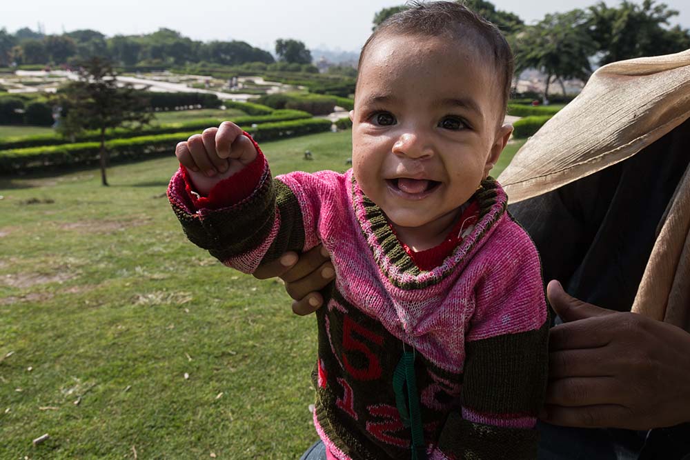 Rawda after her cleft lip surgery playing in the park