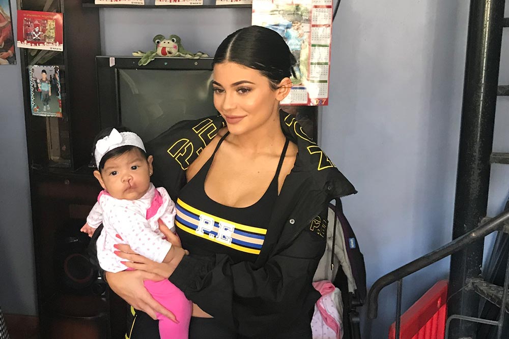 Kylie Jenner holding a baby with cleft