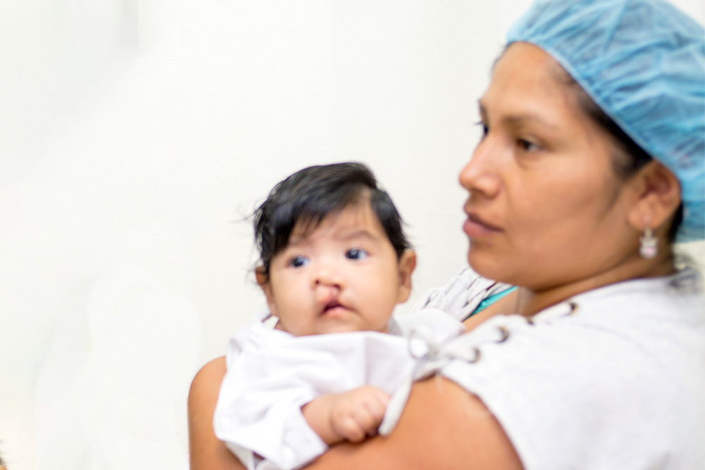 Luz holds Mia before cleft surgery