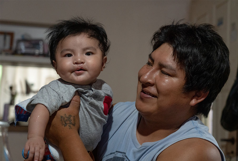 Jose and Miguel after cleft surgery