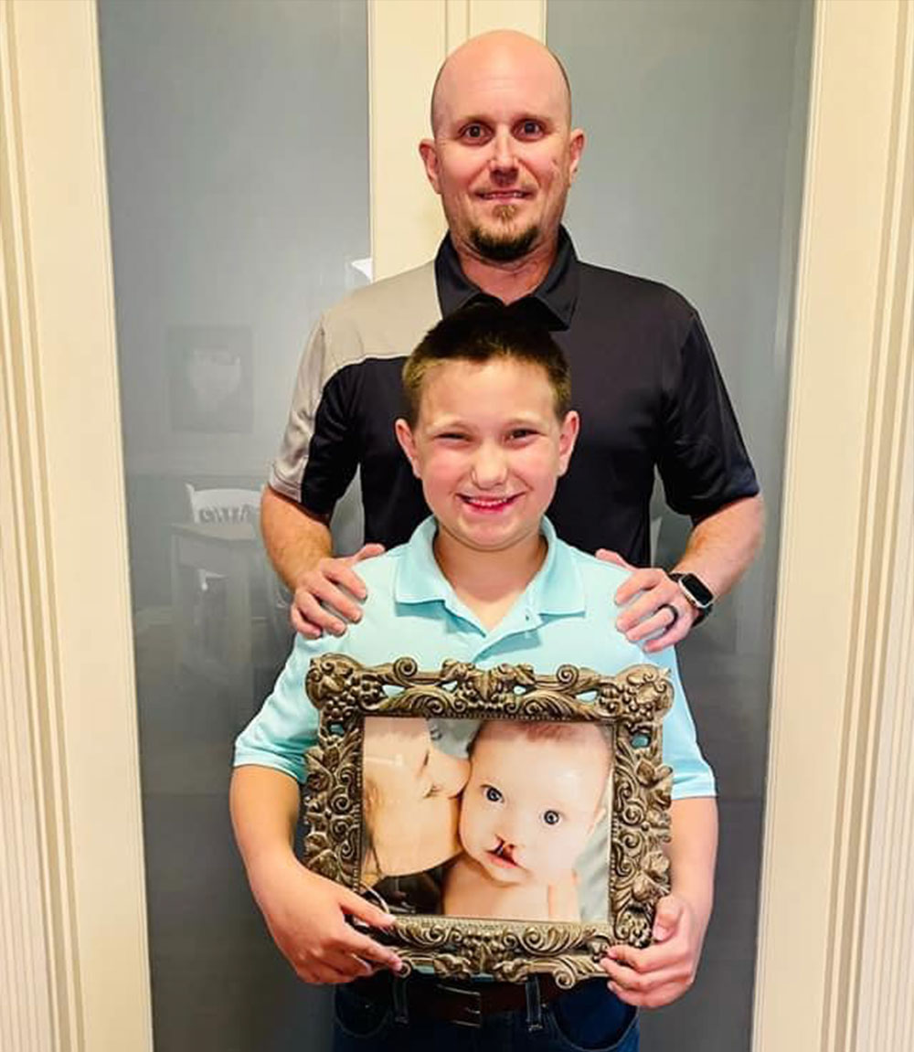 Eddie with Parker, who is holding a picture of himself before cleft surgery