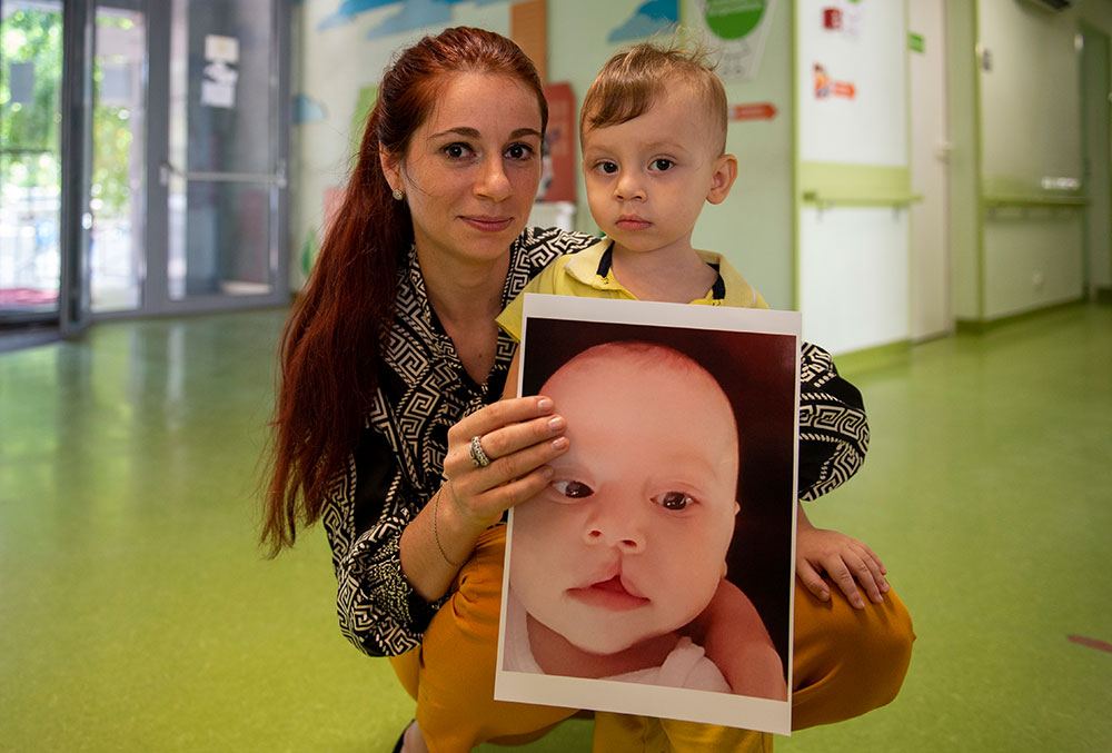 Adelina holding Ionut now and a picture of him before cleft surgery
