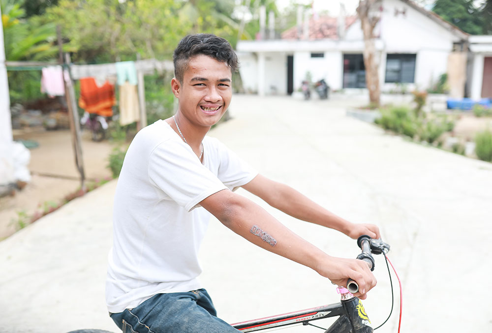 Angga riding a bike after his cleft surgery