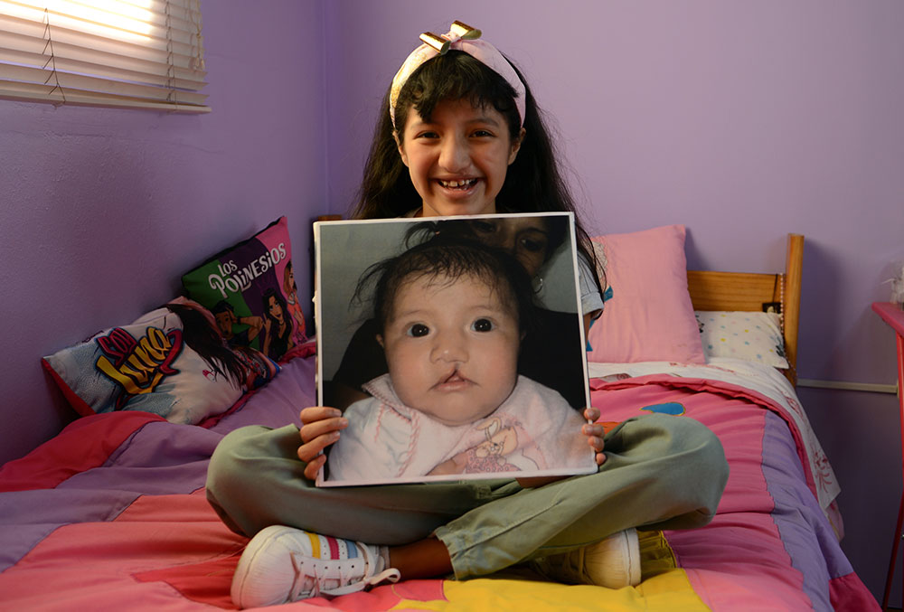 Estephany holding a picture of herself before her Smile Train-sponsored cleft surgery