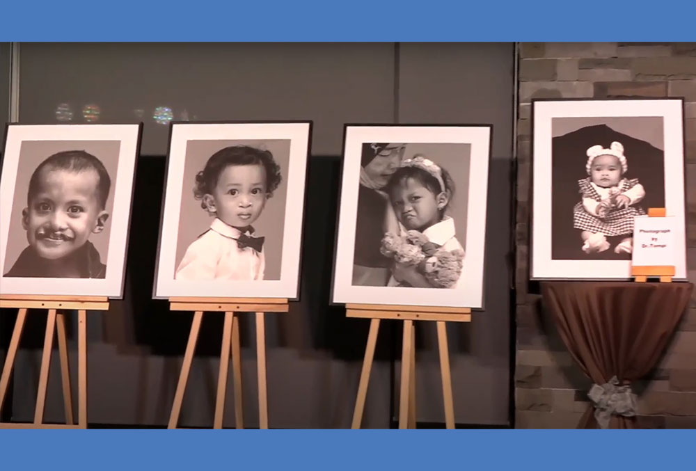 Some of Dr. Tompi's portraits of people with clefts