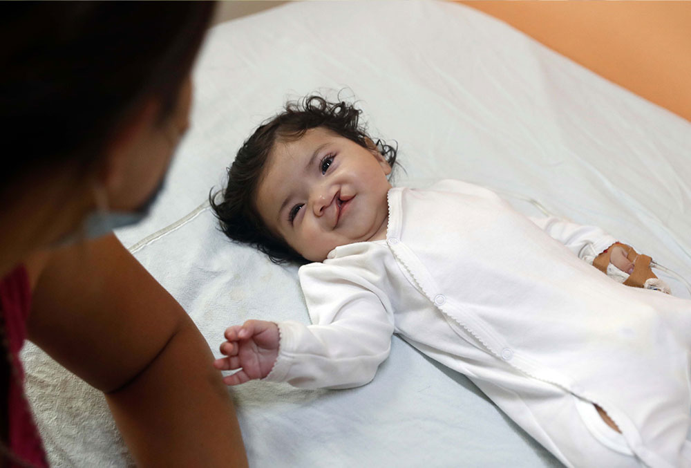 Gianna laying on a bed before cleft surgery