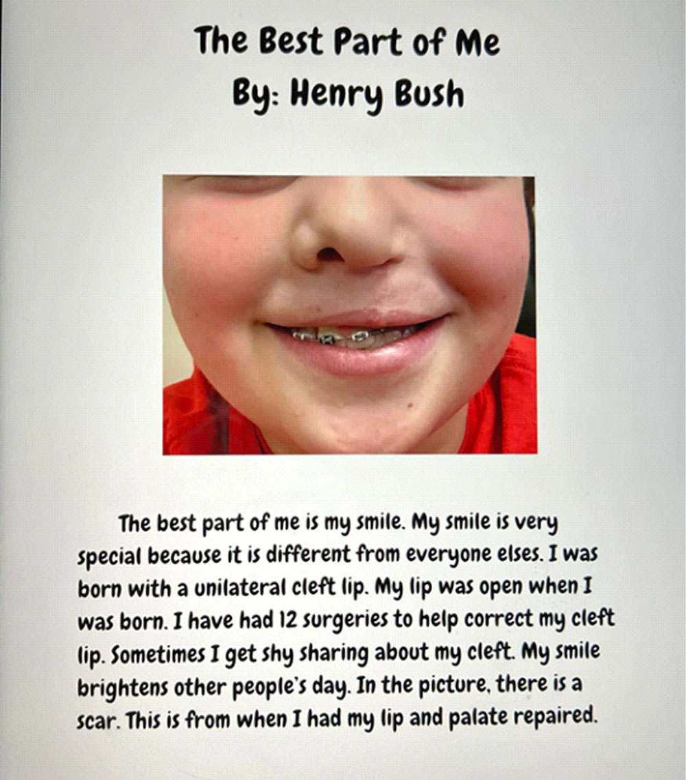 Henry's assignment for school explaining why he considers his cleft "The Best Part of Me"