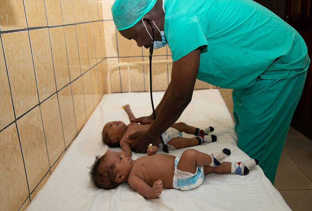 Prof. Tambo examines the twins before their cleft surgeries