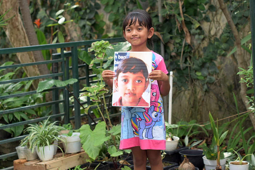 Yumna holding a photo of her before surgery