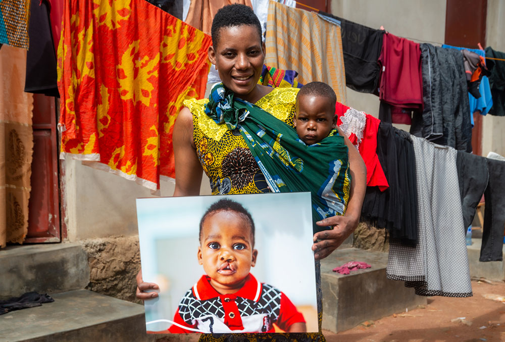 Annette holding a picture of Vedastus before cleft surgery