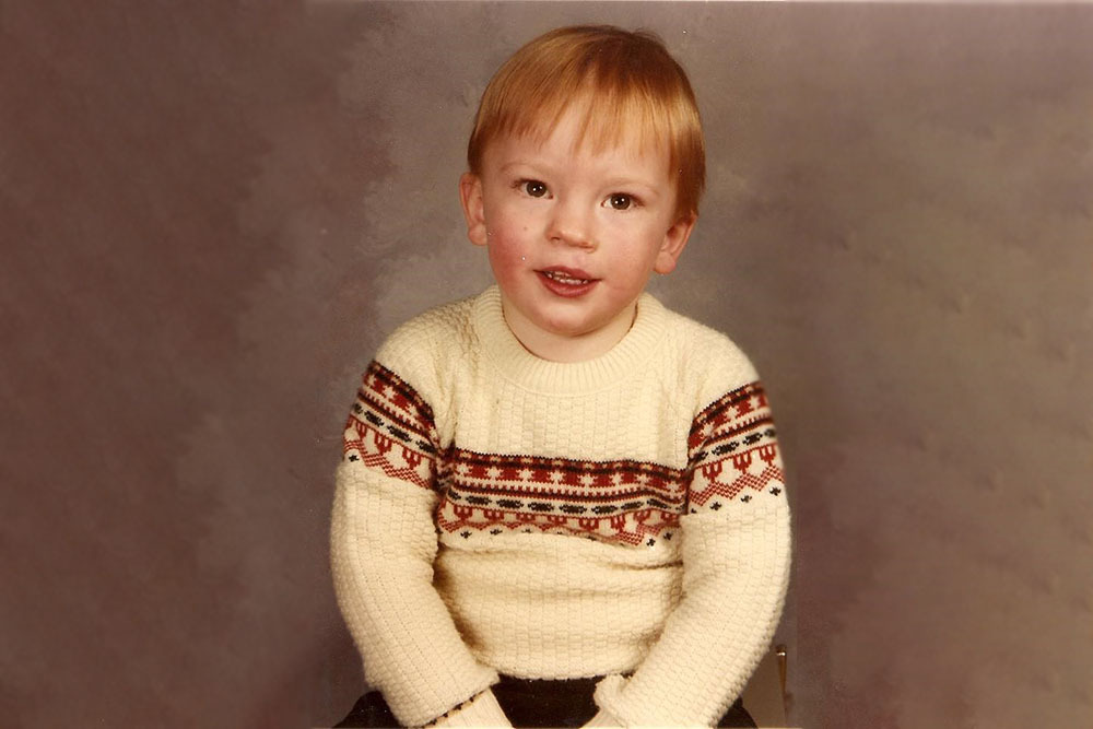 Jim Rowe as a boy after cleft surgery