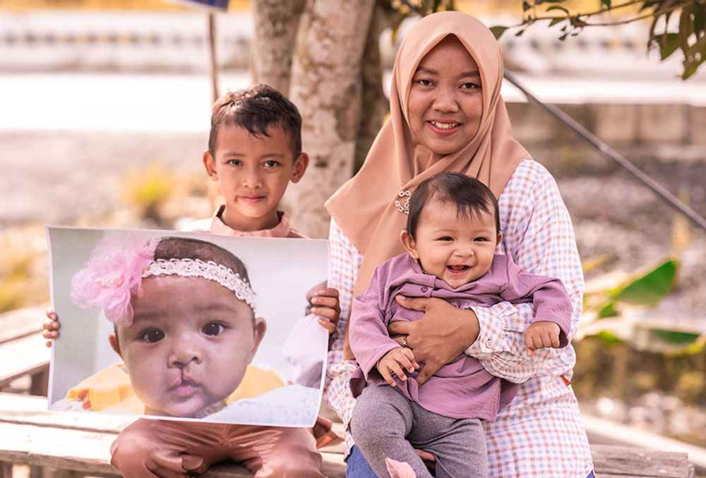 Divya with her family smiling and holding a photo of herself before cleft surgery