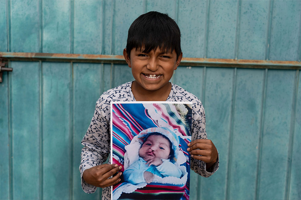 Luis today, holding a picture of himself before cleft surgery