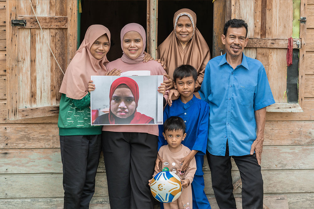 Zuzi, holding a picture of herself before cleft surgery, with her parents and siblings