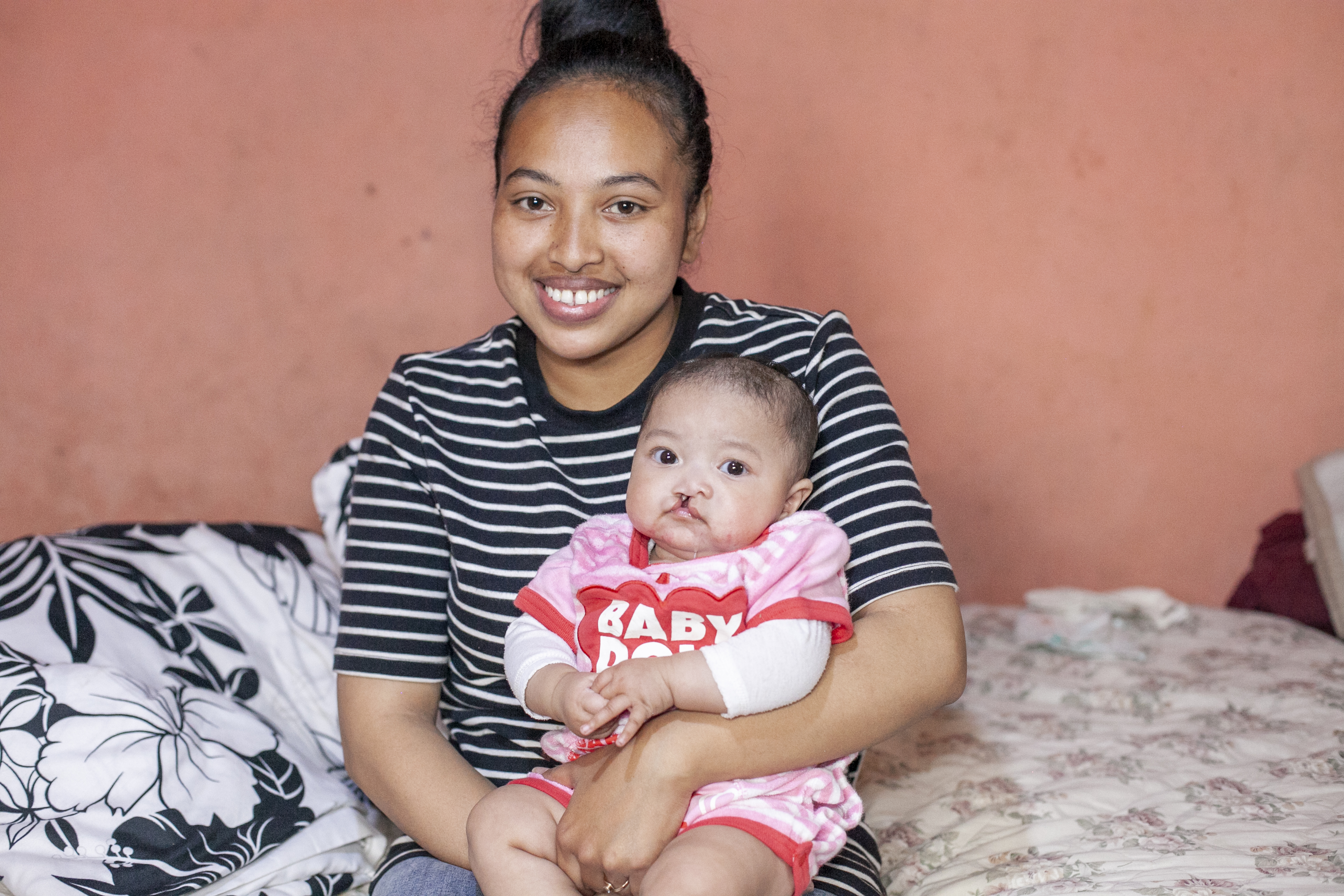 Fy's mother Sylvie holding her before her surgery