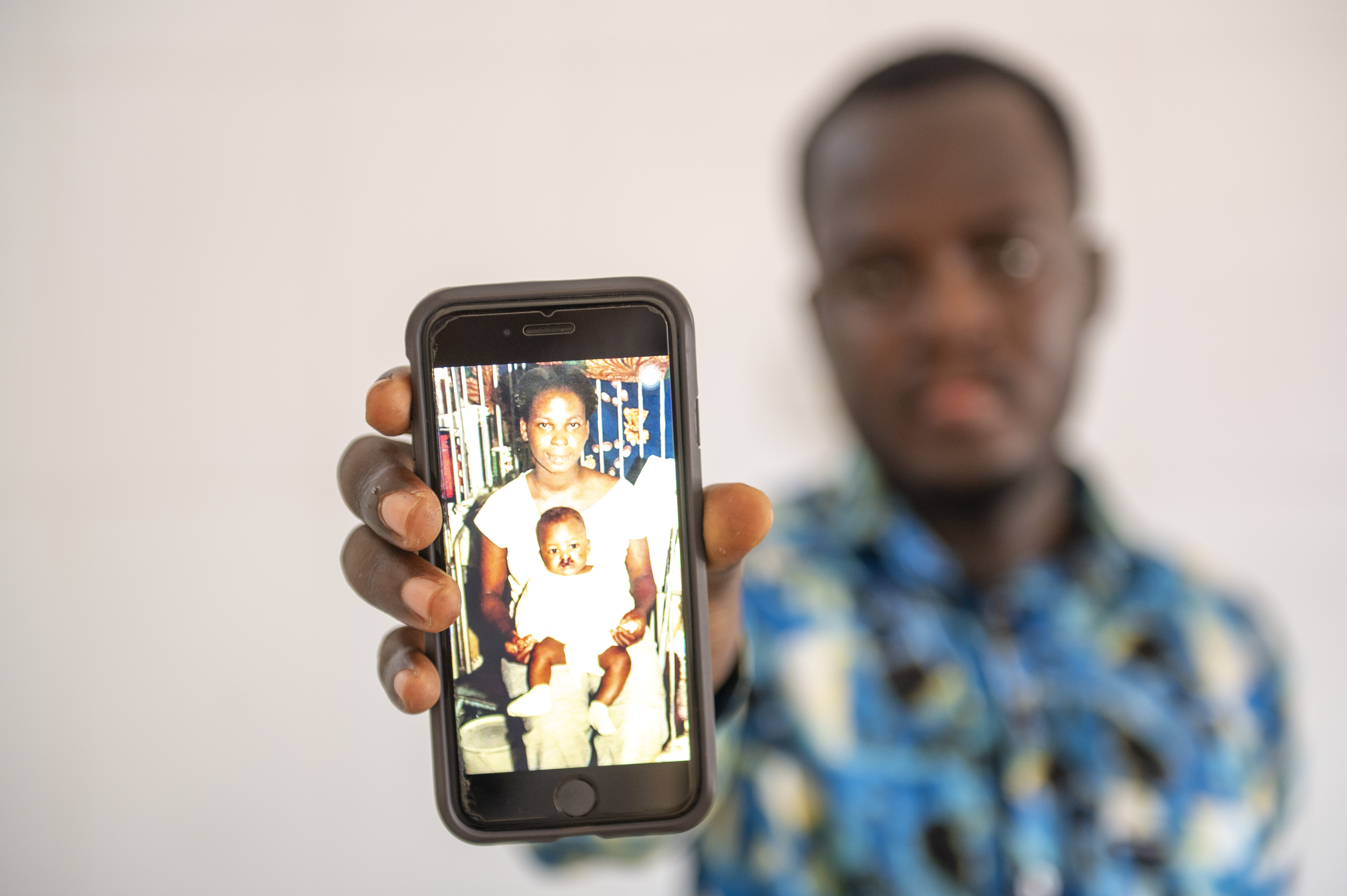 Kelvin holding a photo of himself as a baby before cleft surgery