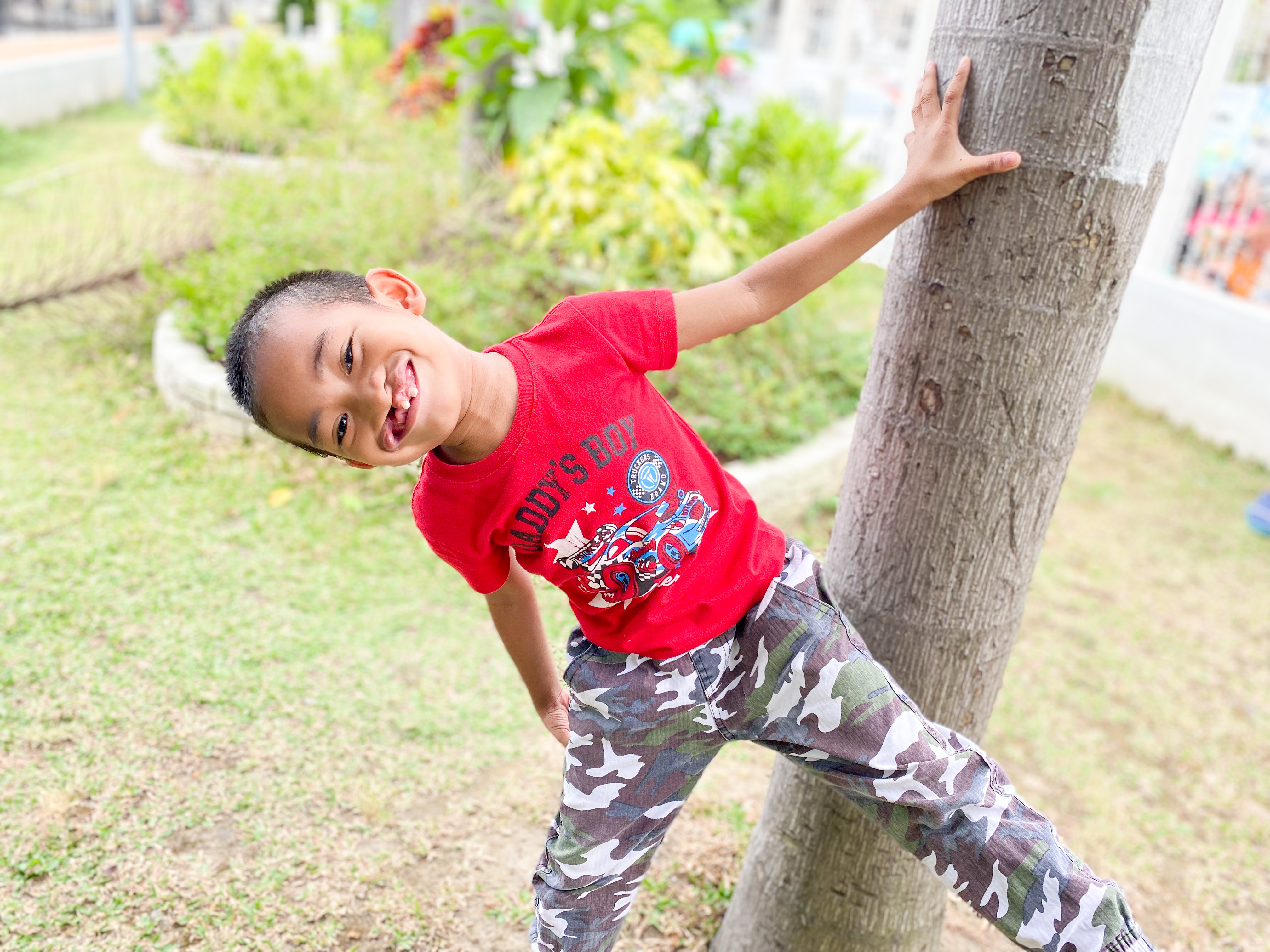 Kyle before his cleft surgery hanging off of a tree