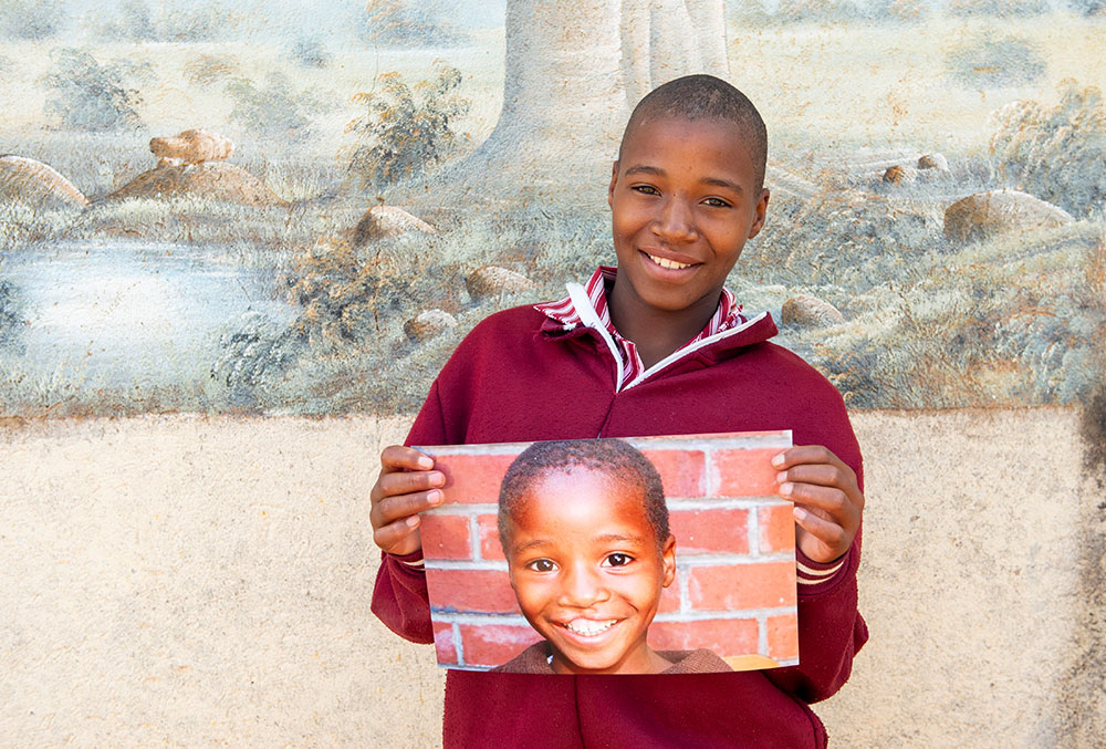 Zimbabwean Smile Train patient Munashe smiling and holding a picture of herself before cleft surgery