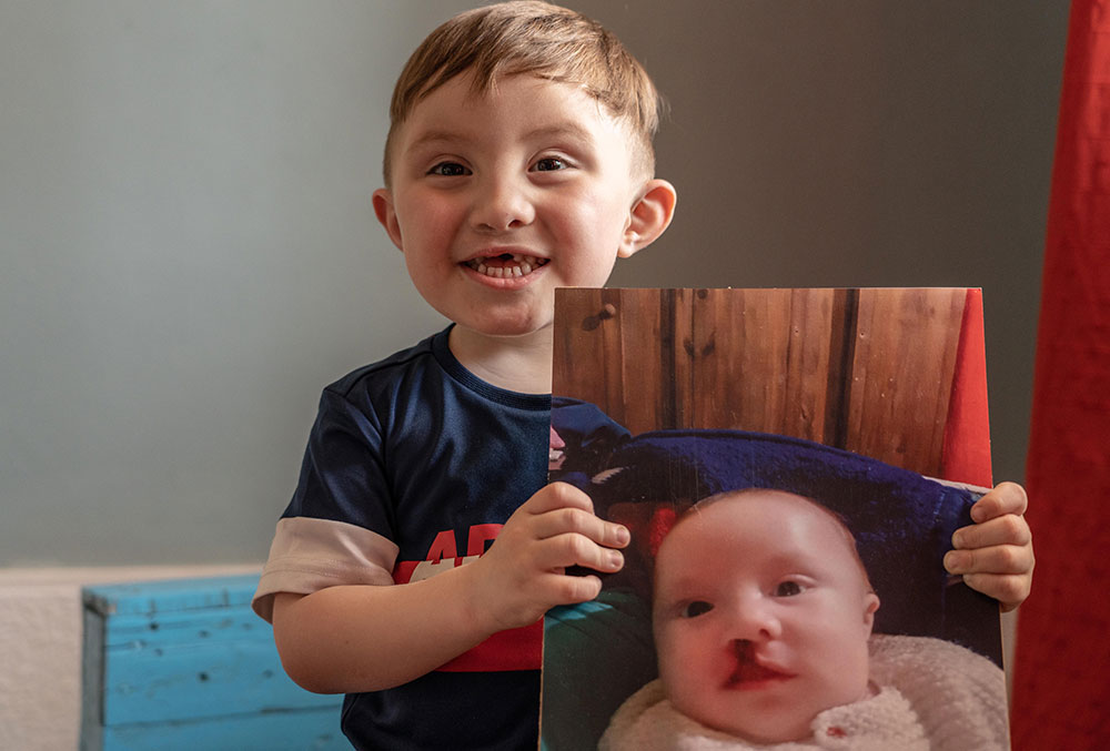 Edden, smiling, holding a picture of himself before cleft surgery