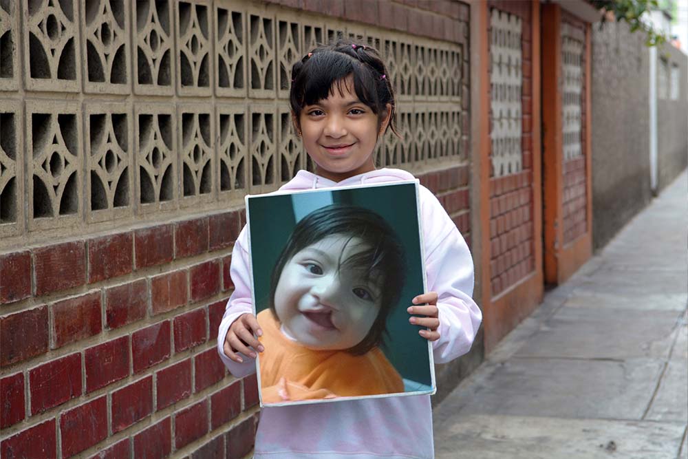 Bhania holds up a photo of herself before cleft treatment