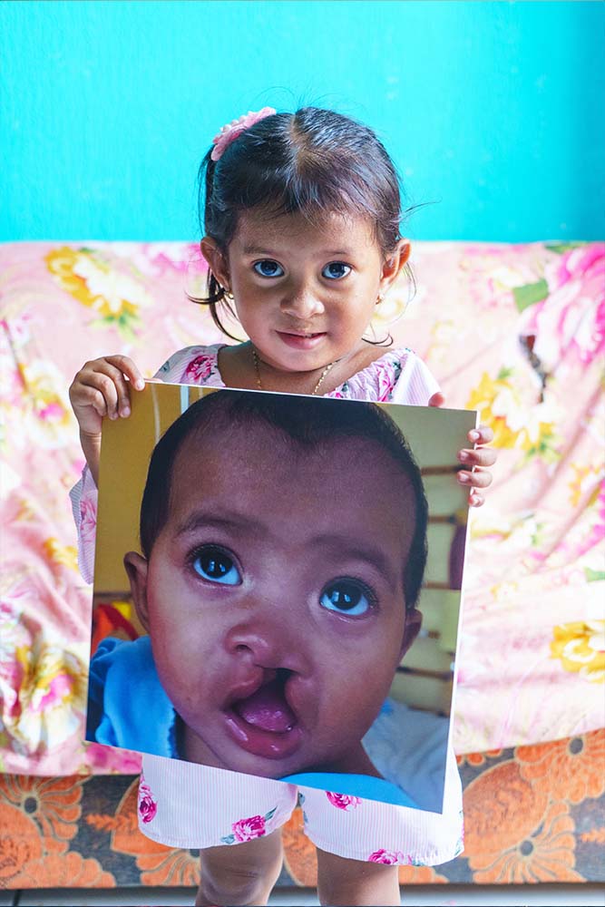 Elieth holds up a photo of herself from before cleft treatment