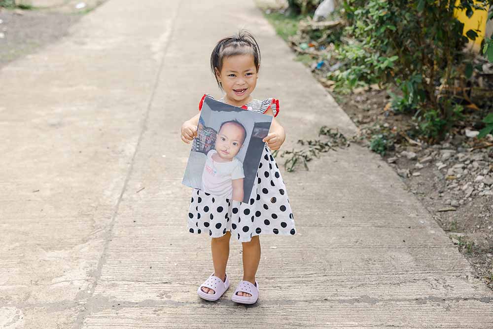 Kaylee smiling and holding a photo of herself before cleft surgery