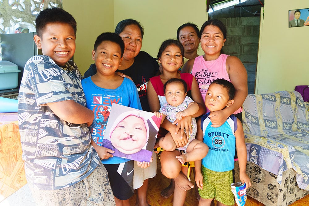 Brithany with her mother, aunt, grandmother, and cousins. One cousin holds a picture of her before cleft surgery