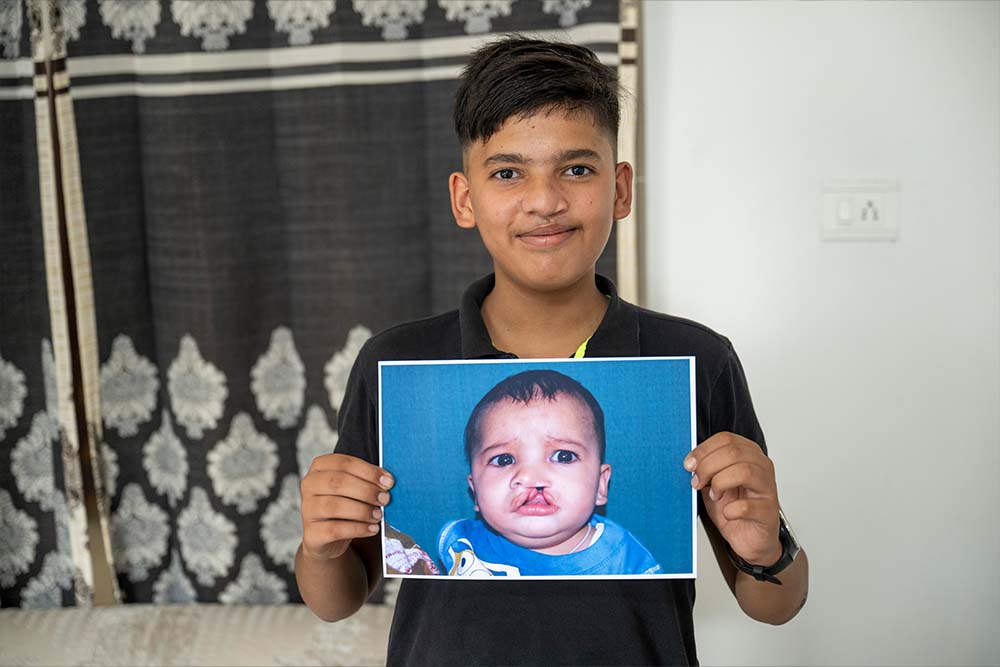 Swastik smiles and holds up a photo of himself as an infant from before cleft care