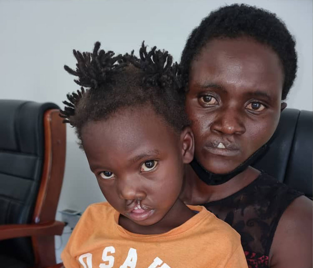 Siriza holding Janerose in her lap just before her cleft surgery Zimbabwe