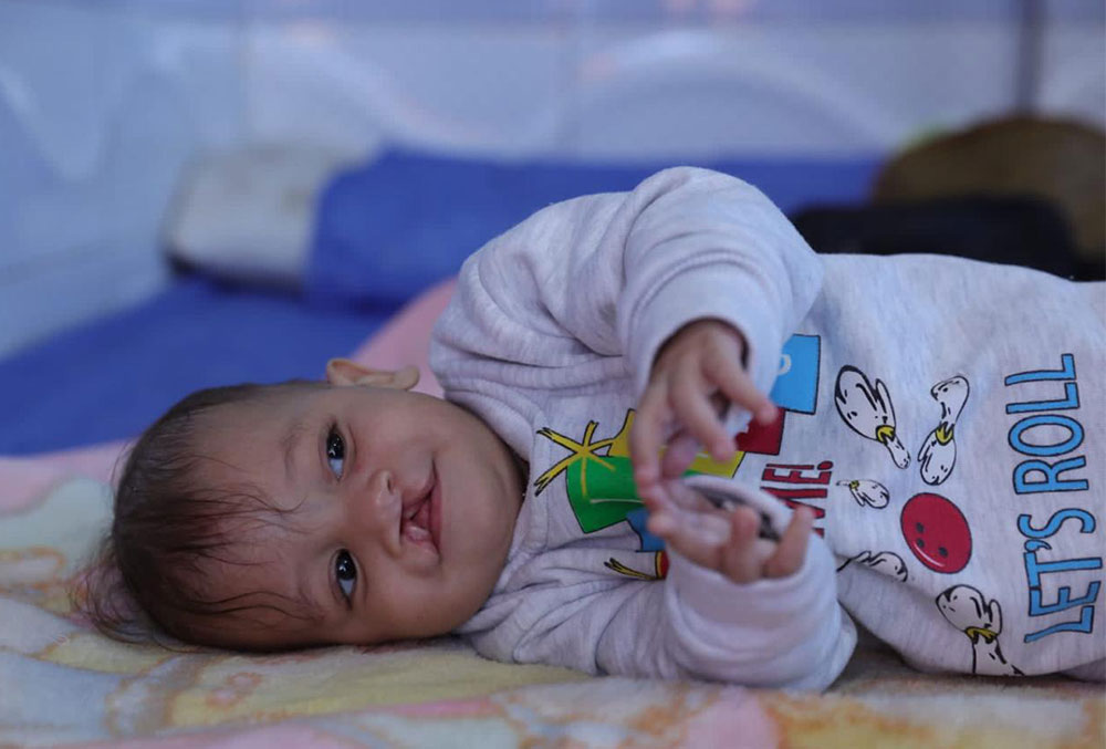 Noah laying on his side before free cleft surgery Egypt
