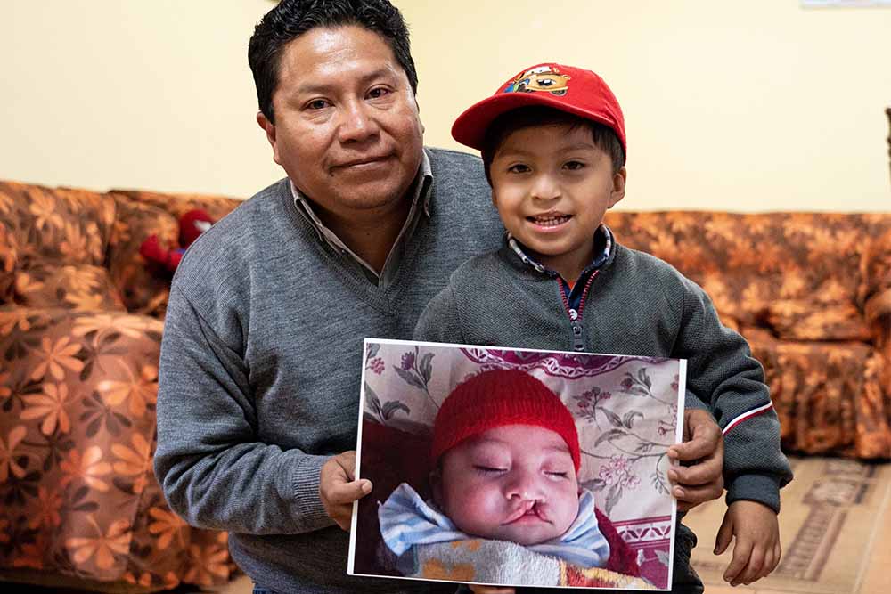 Rene stands behind Daniel. He wraps his arms around him and holds up a photo of Daniel from before cleft treatment