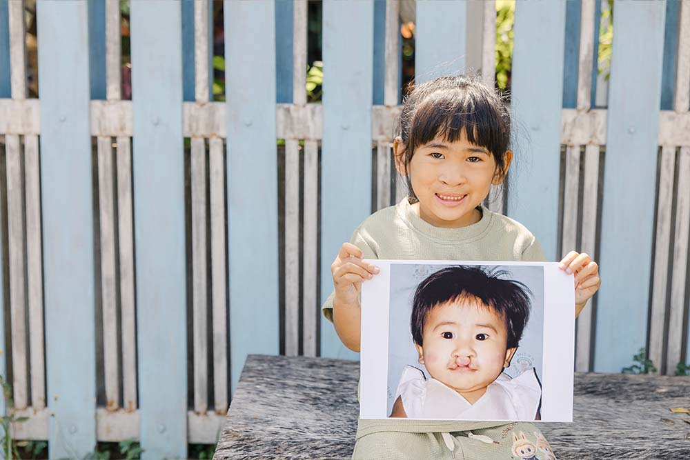 Niu smiling and holding a picture of herself before cleft surgery