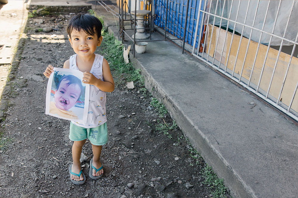 Adrielle holding a picture of himself before cleft surgery