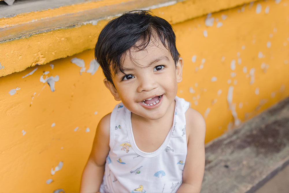 Adrielle smiling today, after cleft surgery