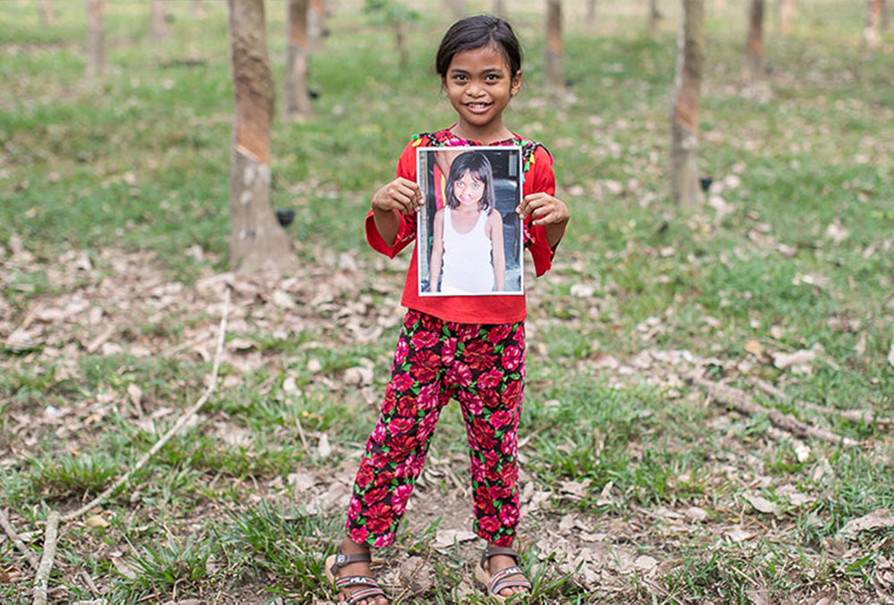 Aira holding a picture of herself before cleft surgery
