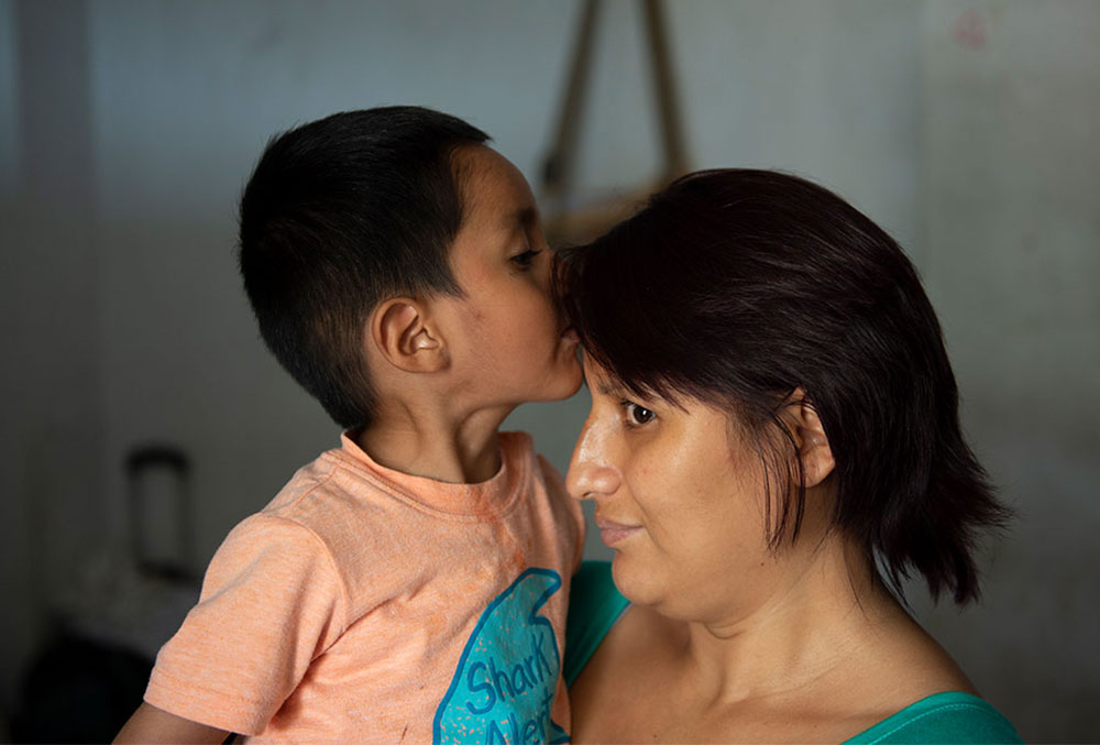 Anghelo kissing his mother on the top of her head after free cleft surgery in Peru
