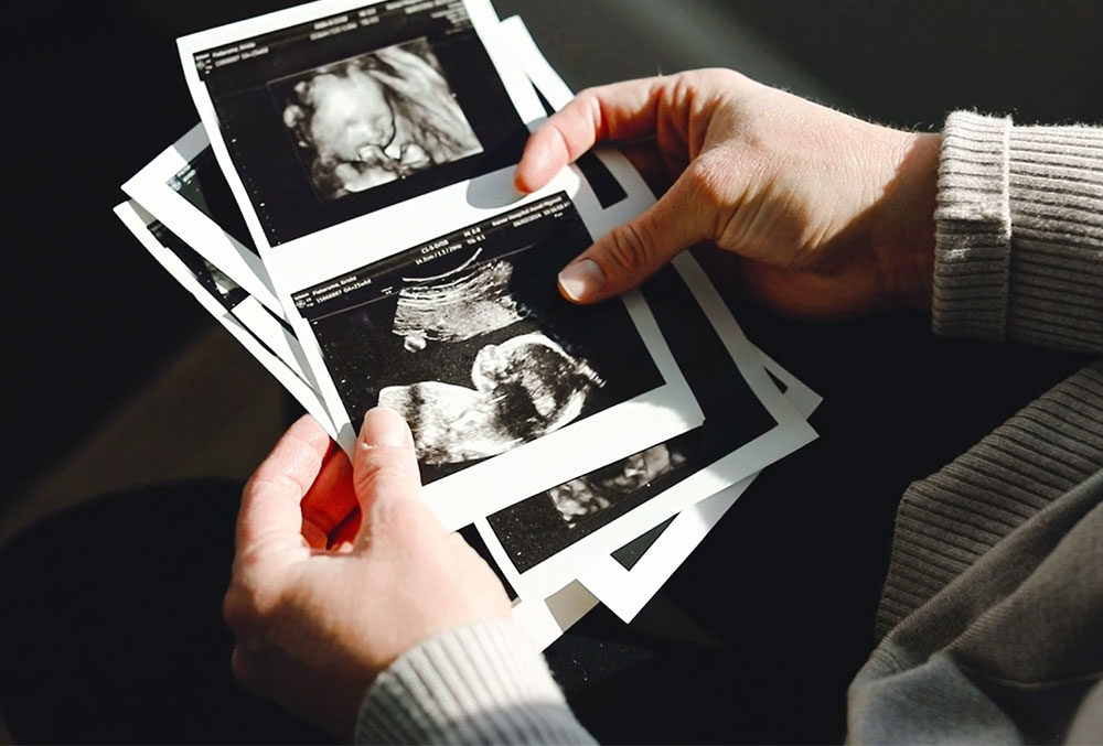 Krista thumbing through ultrasounds of her son with a cleft